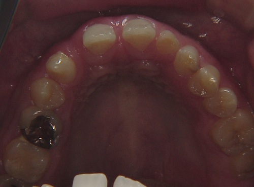 niigata_ whitening_ok2.jpg